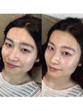 マナ ワクシング 海浜幕張(Mana waxing)/ツヤ肌wax/フェイシャルwax/幕張