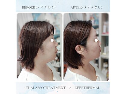 ティアス(t-us)の写真