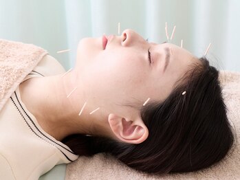 リジョイス(Rejoice)の写真/【美容鍼×よもぎ蒸し】血行促進&タ-ンオ-バ-の促進で毛穴の引き締め効果◎美肌とサイズダウンを叶えます♪