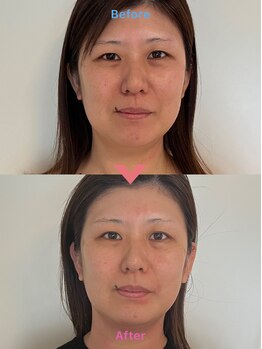 エテル(eter)/フェイシャル＋ヘッドケア90分