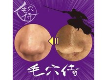 毛穴悩みに特化して作られた"毛穴侍"美鼻に！