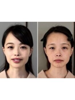 豊富な専門知識でアドバイス