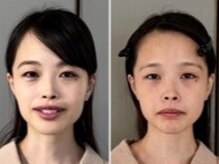 チャチャ(CHACHA)