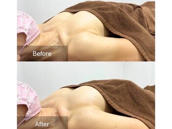 アファン 鶴見店(Afun)/バストアップBeforeAfter