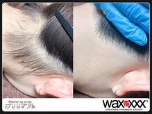 ブリリアント/うなじのwax脱毛