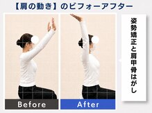 ウェルメディカル 豊中駅前整体院/整体×姿勢矯正【肩こり/腰痛】
