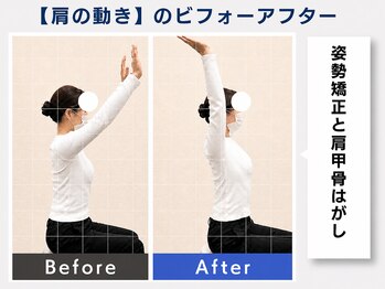 ウェルメディカル 豊中駅前整体院/整体×姿勢矯正【肩こり/腰痛】