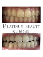プラチナムビューティー 名古屋栄本店(PLATINUM BEAUTY)/お客様Before After