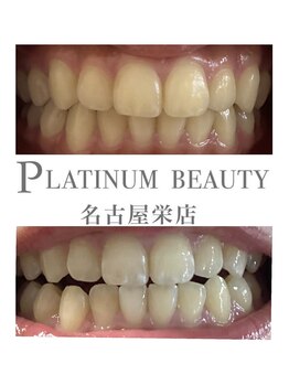 プラチナムビューティー 名古屋栄本店(PLATINUM BEAUTY)/お客様Before After