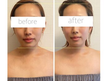 パル コルギサロン(Pal. Korugi salon)/コルギビフォーアフター