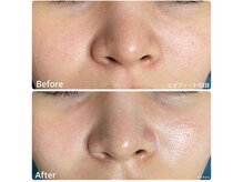 ちらちゅら/クリスティーナ【ビオフィート】