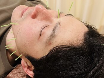 茶ノ木鍼灸整骨院/美容鍼 美肌トリートメント