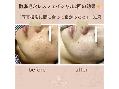 ネリネ(Nerine)の写真