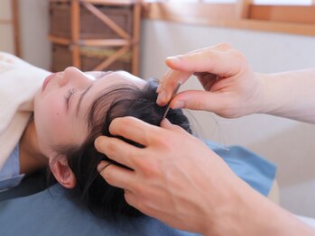 神戸北野はり灸院の写真/【痛みの少ない金銀鍼を使用】カウンセリングで美容の悩み＆身体の不調の原因を発見し分かりやすくご説明♪