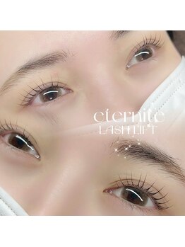 エテルニテ(eternite)/