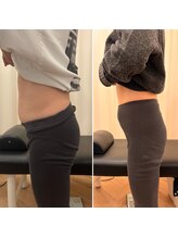 ナオ接骨院(NAO接骨院)/Before／After