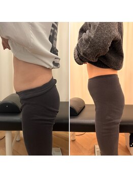 ナオ接骨院(NAO接骨院)/Before/After