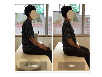 ナオル整体 熊本院(NAORU整体)/【20代男性施術事例 猫背姿勢】
