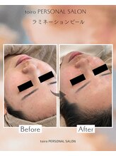 トイロ(toiro)/ラミネーションピール