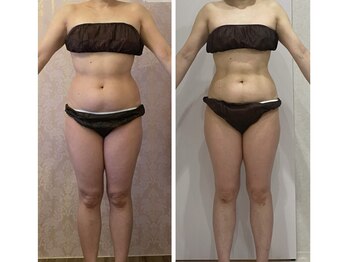 ルポーゼ(Repose)/