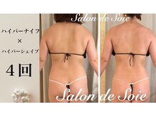 サロン ド ソワ(Salon de Soie)の雰囲気（【ハイパーナイフ×ハイパーシェイプ】フォトギャラリーをCheck）