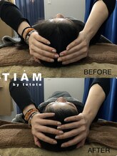 ティアム バイ テトテ 神戸三宮(TIAM by tetote)/小顔矯正で頭もスッキリ