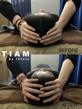 ティアム バイ テトテ 神戸三宮(TIAM by tetote)/小顔矯正で頭もスッキリ