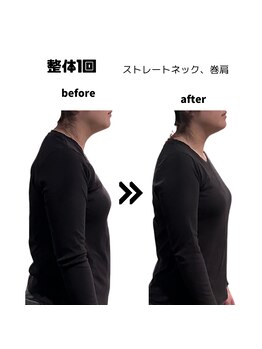 マカニ(Makani)/ストレートネック改善