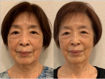 ビビアンローズ(BIBIAN ROSE)/80代でも遅くはありません