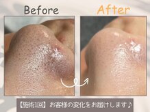 エレ(ele)の雰囲気（初めての方にも◎剥けないハーブで始める美肌♪）