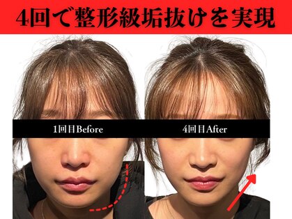 アロエベル(aloe Belle)の写真