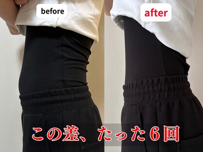 アルク(ALUKU)の写真