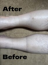 ホークシャイン(HAWK SHINE)/むくみでお悩みのお客様