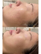 ハーブのほし/根本から見直しで永久美を追求
