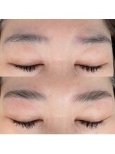 サロン ド 花歩 松山本店/アイブロウスタイリング＋顔脱毛