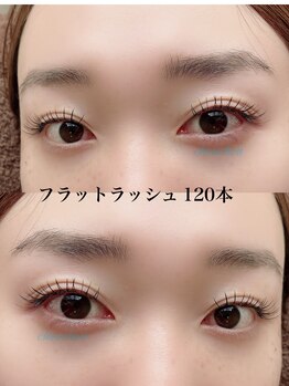 シュシュ(chouchou)/フラットラッシュ