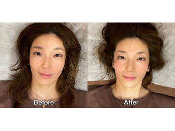 こじま 富雄団地接骨院/Before&After