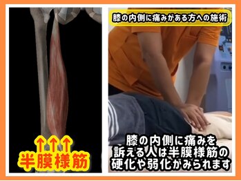 おかざき整骨院/膝の内側の痛みに対する施術