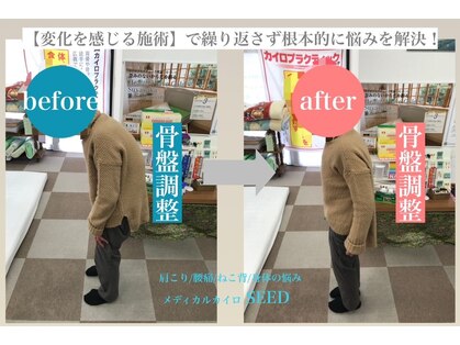 シード(SEED)の写真