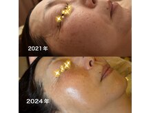 エステサロン グラマラスの雰囲気（月1回フェイシャルで潤い艶肌作り☆幾つになっても健康素肌！）