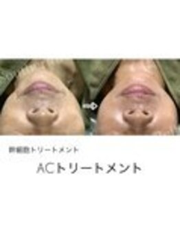 サザンベル 石垣店(SOUTHERN BELLE)/リアボーテACトリートメント