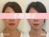 人気No.1！男女OK！【むくみ・たるみ改善・歪み】小顔矯正8800円→4800円