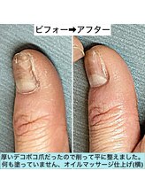 桃の木 吉祥寺店/代謝が悪い爪もネイルケアで健康