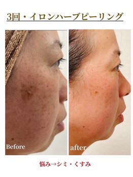 ラブランフェアリー/ハーブピーリングも登場！