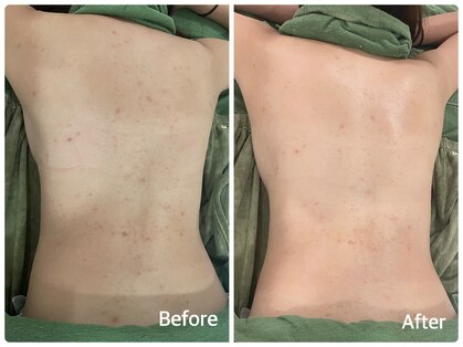 アミュレット(Amulette)の写真