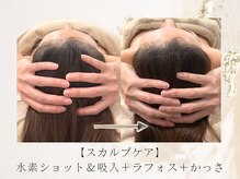 アネラボーテ(Anela Beaute)/脳洗浄×頭皮ケア×眼精疲労改善