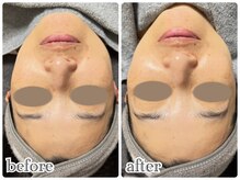 ニュイ(nuit)/グロスピール1回目