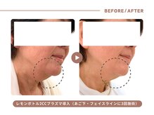 イエス マイサロン(yes My Salon)の雰囲気(【奇跡の小顔美容液レモンボトル】韓国発の最新脂肪分解施術)