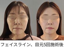 ヴェリタス(VERITAS)の雰囲気(小顔施術は首肩の筋膜もリリースし、下がらない状態へアプローチ)