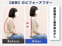 ウェルメディカル 豊中駅前整体院/整体×姿勢矯正【肩こり/腰痛】